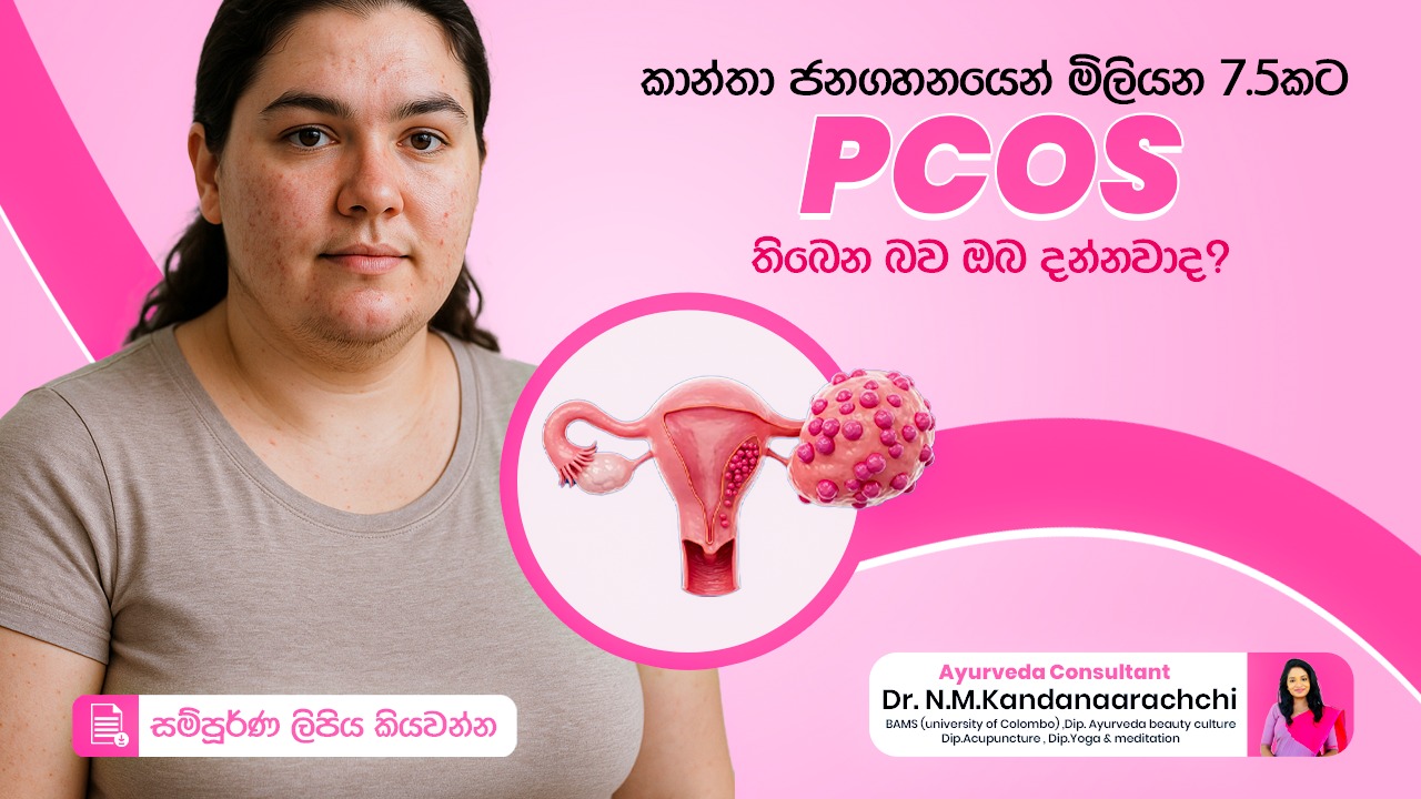 PCOS පිළිබඳව ඔබ දැනුවත්ද?