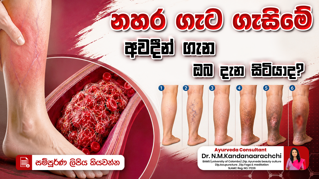 නහර ගැට ගැසිමේ අවදීන් ගැන ඔබ දැන සිටියාද?